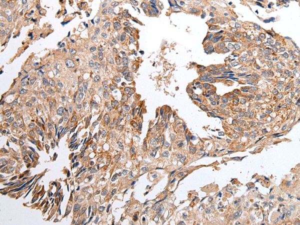 Rabbit Polyclonal Antibody to IFI16