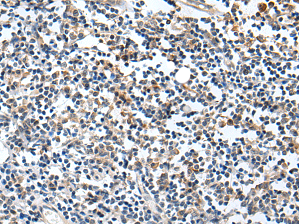 Rabbit Polyclonal Antibody to NRG1