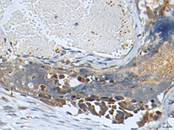 Rabbit Polyclonal Antibody to SLC16A6