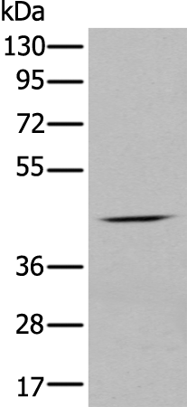 Rabbit Polyclonal Antibody to CHRNA5