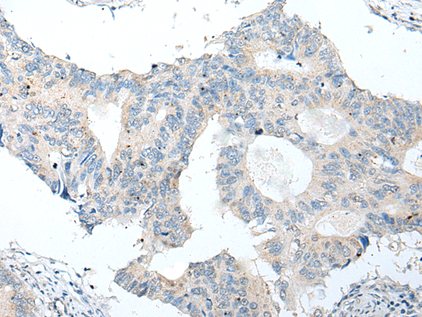 Rabbit Polyclonal Antibody to ALPK2