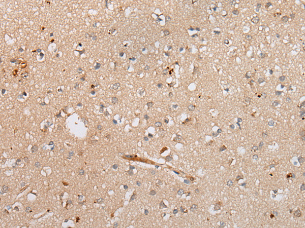 Rabbit Polyclonal Antibody to TNIK