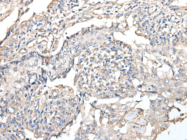 Rabbit Polyclonal Antibody to RPTOR