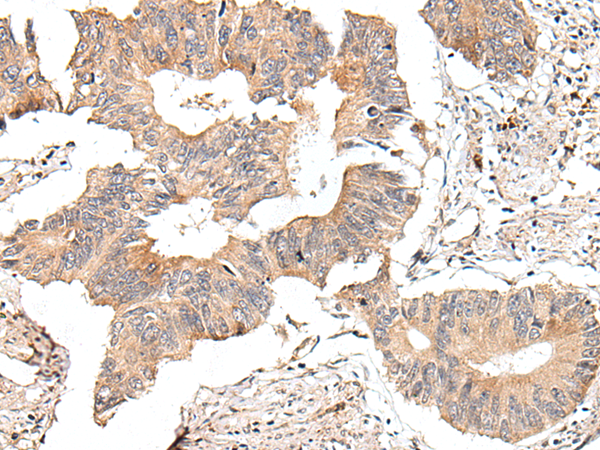 Rabbit Polyclonal Antibody to ACAN