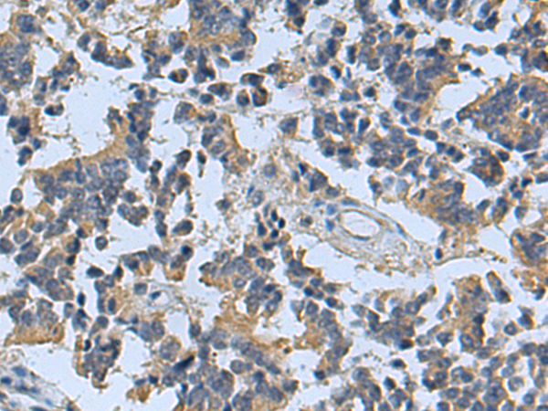 Rabbit Polyclonal Antibody to SLC8A1