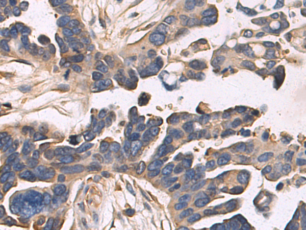 Rabbit Polyclonal Antibody to PTPRG