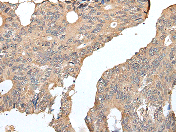Rabbit Polyclonal Antibody to SELENOW