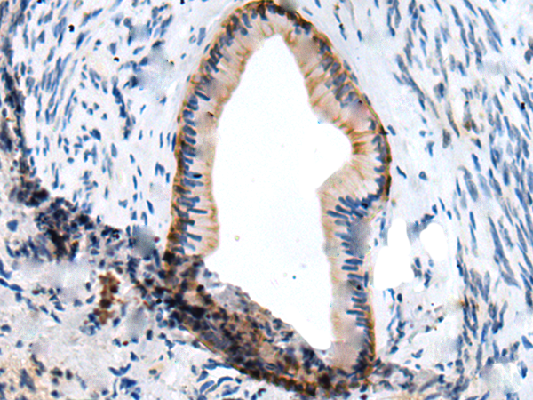 Rabbit Polyclonal Antibody to TNC