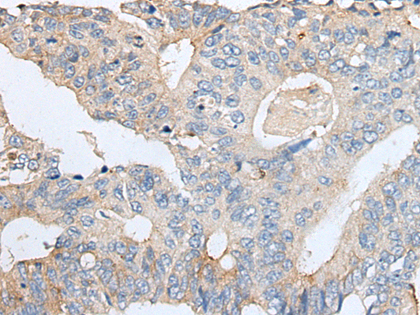 Rabbit Polyclonal Antibody to TGFB3