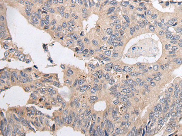 Rabbit Polyclonal Antibody to ARL5A