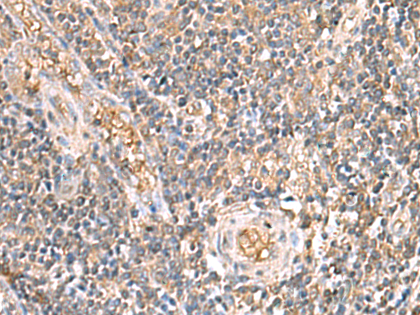Rabbit Polyclonal Antibody to ARF5