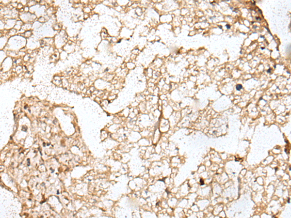 Rabbit Polyclonal Antibody to KNL1