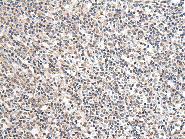Rabbit Polyclonal Antibody to KLHL4