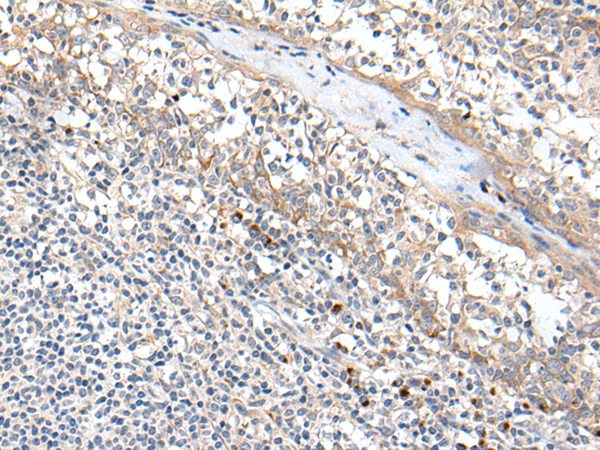 Rabbit Polyclonal Antibody to MT-ND5