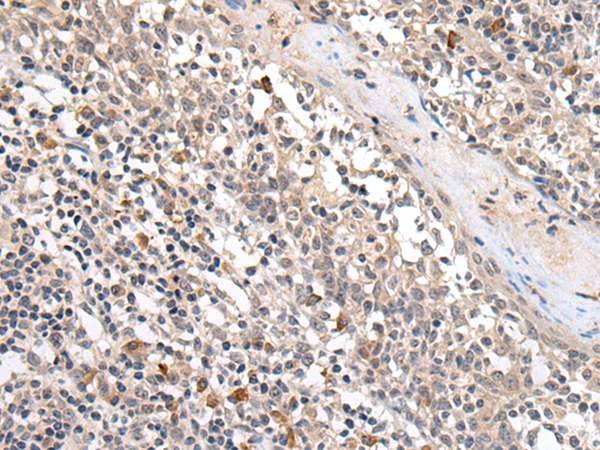 Rabbit Polyclonal Antibody to PROK1