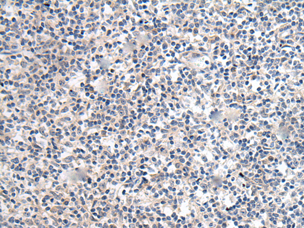 Rabbit Polyclonal Antibody to TGFB1