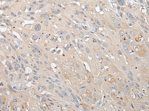 Rabbit Polyclonal Antibody to TGFB1