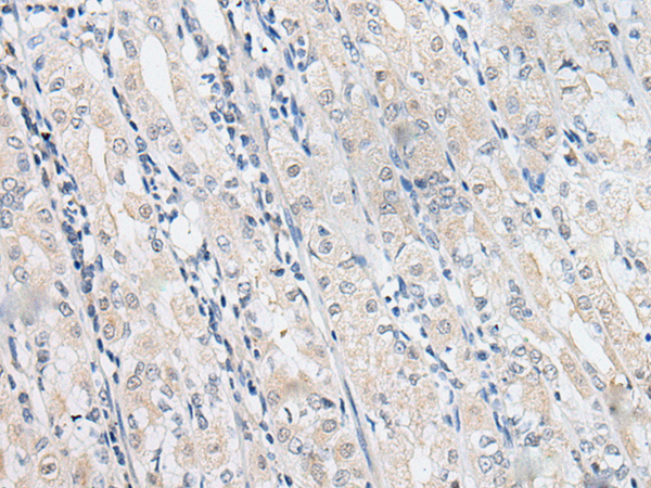 Rabbit Polyclonal Antibody to SLC12A3