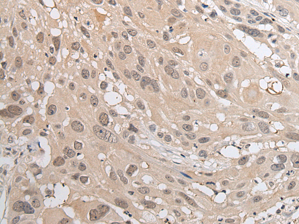 Rabbit Polyclonal Antibody to HOXB9