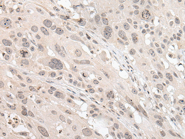 Rabbit Polyclonal Antibody to HOXB7