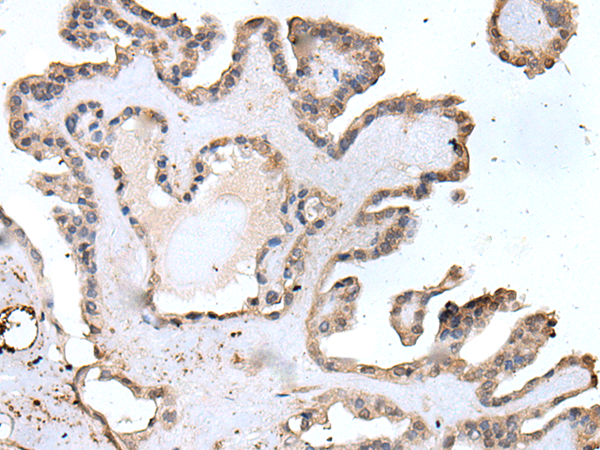 Rabbit Polyclonal Antibody to ACKR3