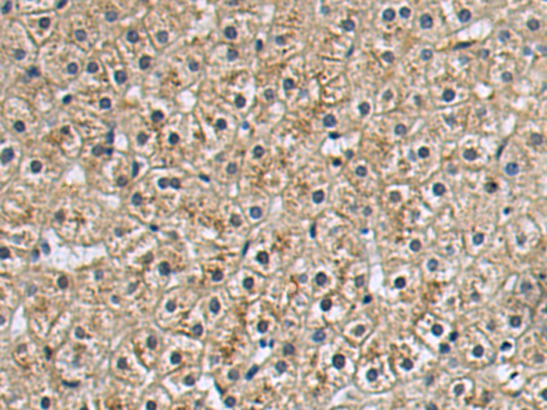 Rabbit Polyclonal Antibody to CNTFR