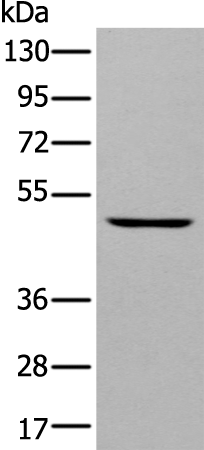 Rabbit Polyclonal Antibody to DAPK2
