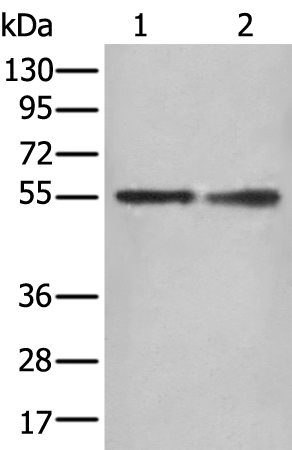 Rabbit Polyclonal Antibody to DES