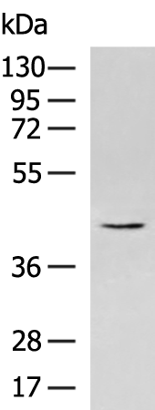 Rabbit Polyclonal Antibody to DOK2