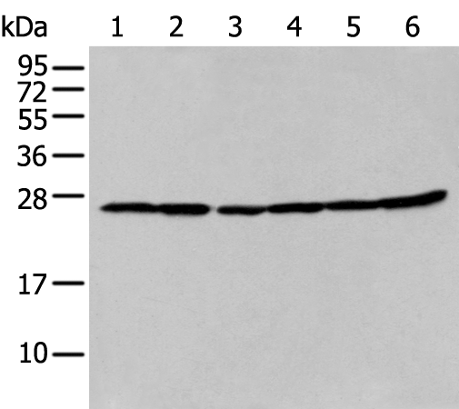 Rabbit Polyclonal Antibody to HSD17B10