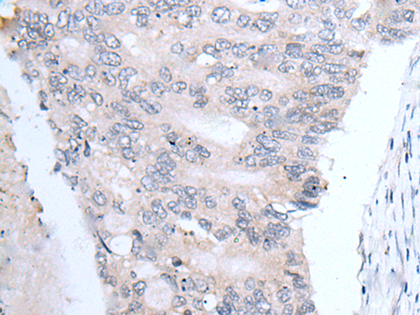 Rabbit Polyclonal Antibody to FABP12