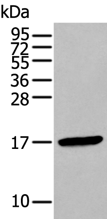 Rabbit Polyclonal Antibody to FSHB