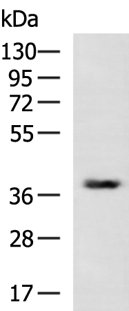 Rabbit Polyclonal Antibody to LGALS9