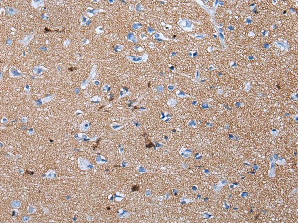 Rabbit Polyclonal Antibody to GAP43