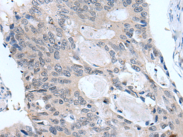 Rabbit Polyclonal Antibody to GAST