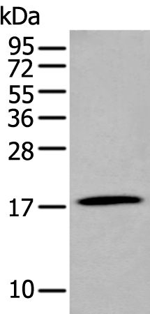 Rabbit Polyclonal Antibody to GKN2