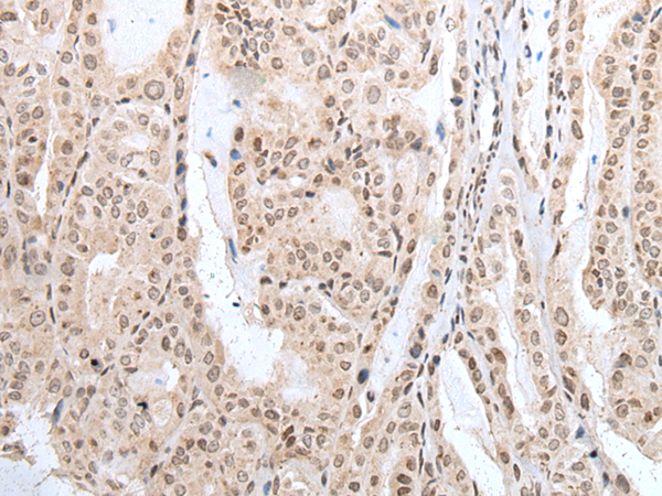Rabbit Polyclonal Antibody to GATA1