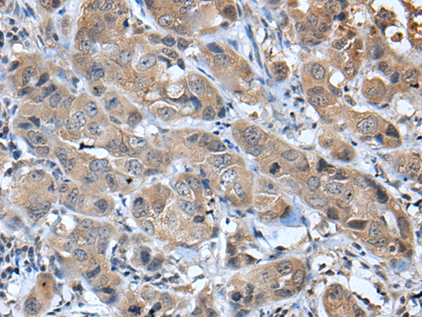 Rabbit Polyclonal Antibody to CXCL5
