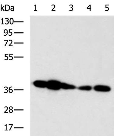 Rabbit Polyclonal Antibody to HOXD3