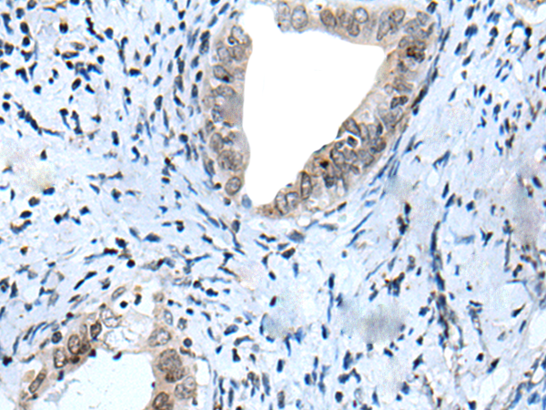 Rabbit Polyclonal Antibody to HOXD12