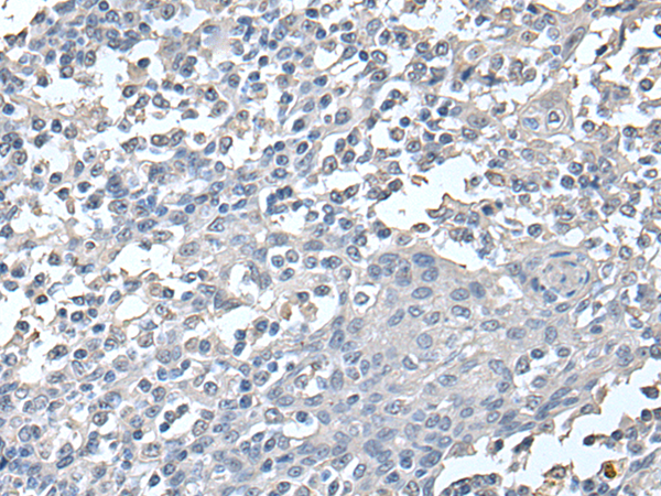 Rabbit Polyclonal Antibody to HSP90AA1