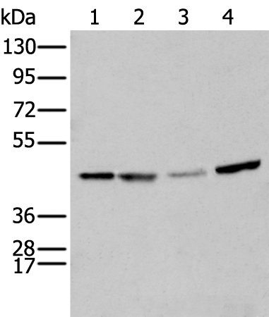Rabbit Polyclonal Antibody to SERPINH1