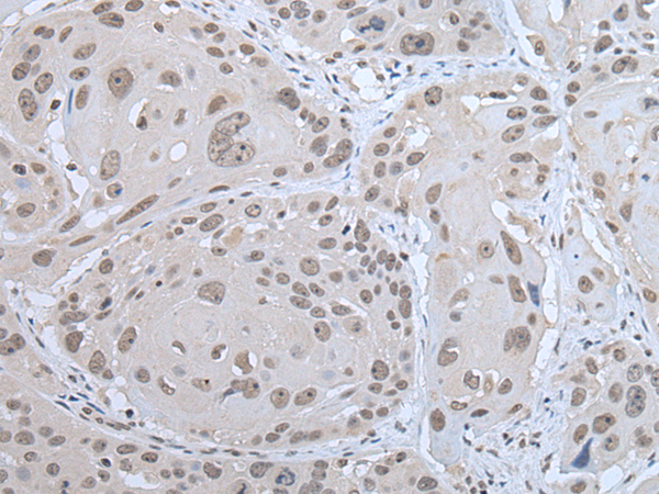 Rabbit Polyclonal Antibody to IFI16