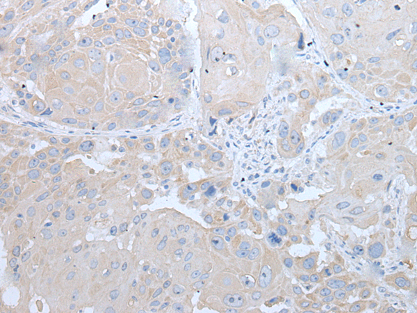 Rabbit Polyclonal Antibody to IFNB1