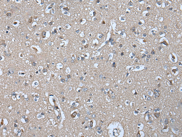 Rabbit Polyclonal Antibody to IQGAP1