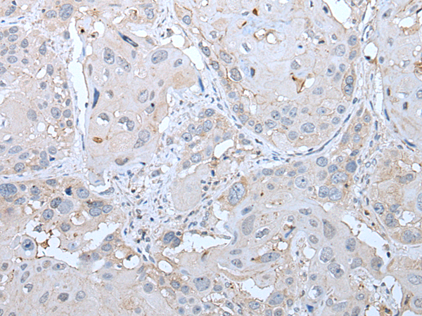 Rabbit Polyclonal Antibody to INSR