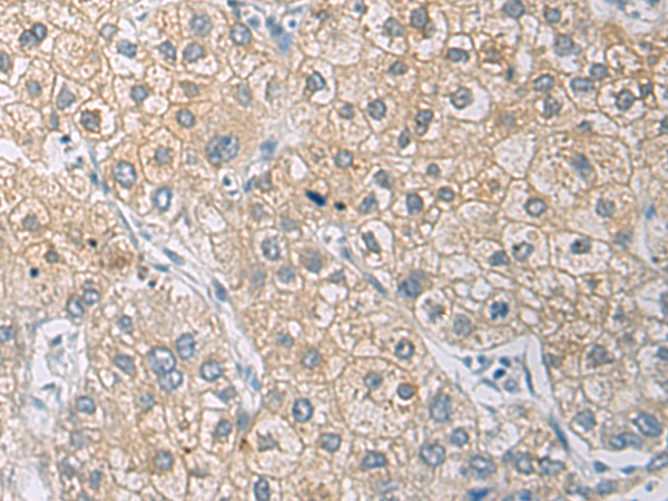 Rabbit Polyclonal Antibody to IL1RN