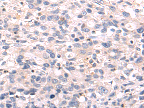Rabbit Polyclonal Antibody to IRAK1