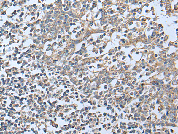 Rabbit Polyclonal Antibody to JAK1