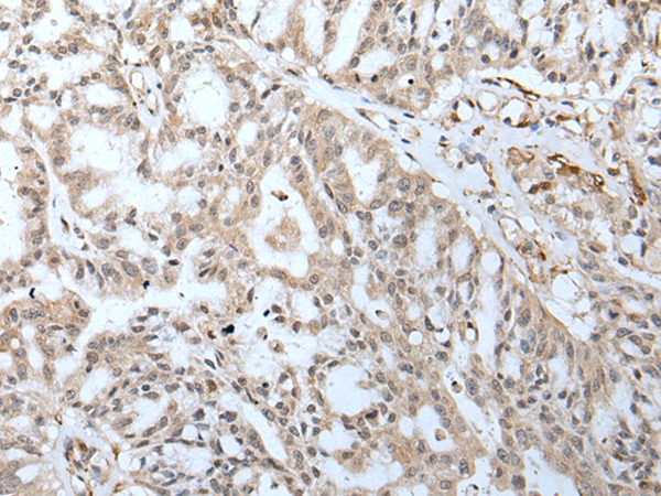 Rabbit Polyclonal Antibody to KLF6